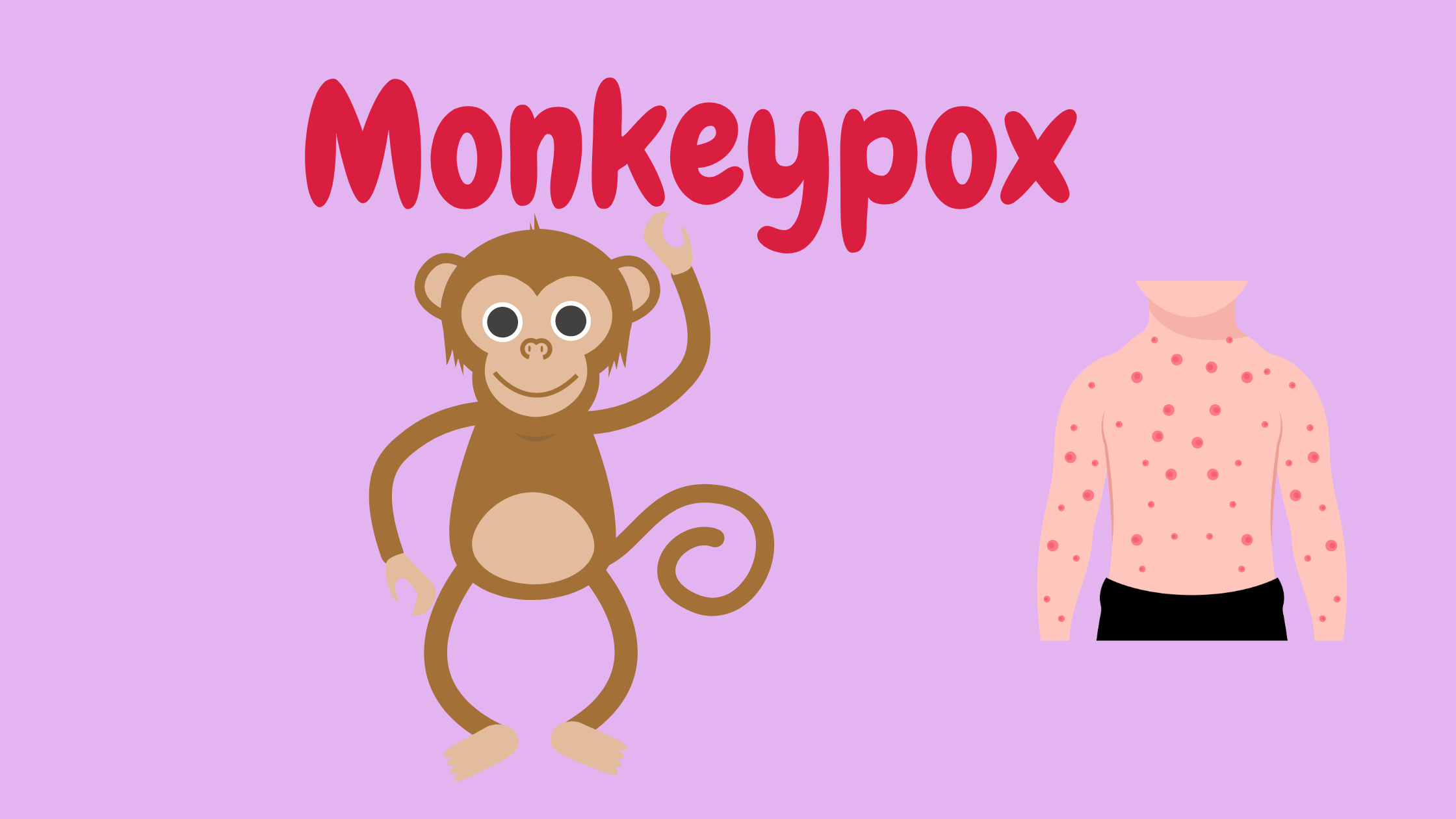 The Monkeypox Outbreak: Latest Updates, Treatment Options, and Prevention Tips | Look and Do!